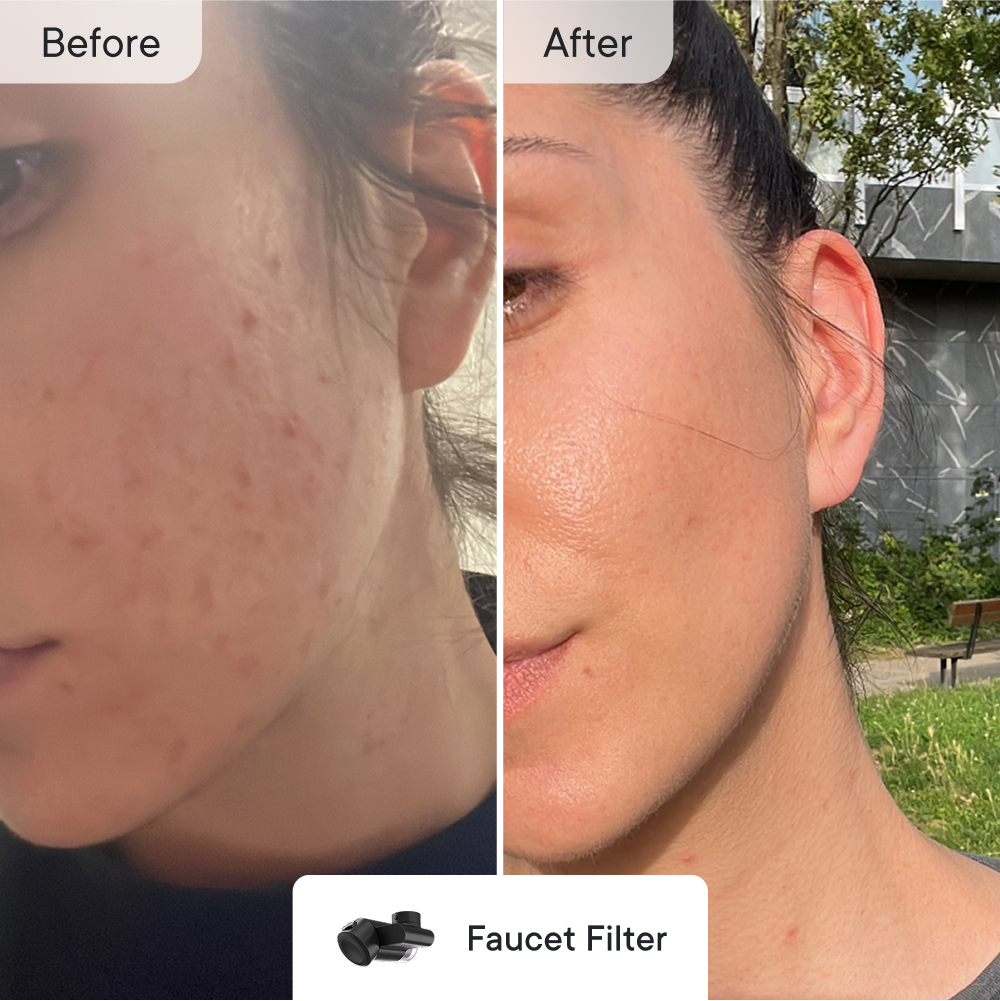 Breakout Control Essentials