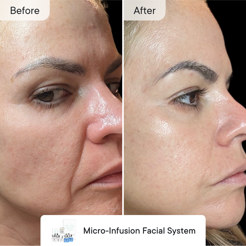 Fade & Firm  Bundle Essential