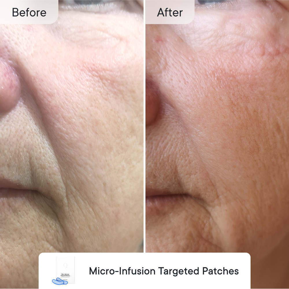 Line Refine Bundle Essential