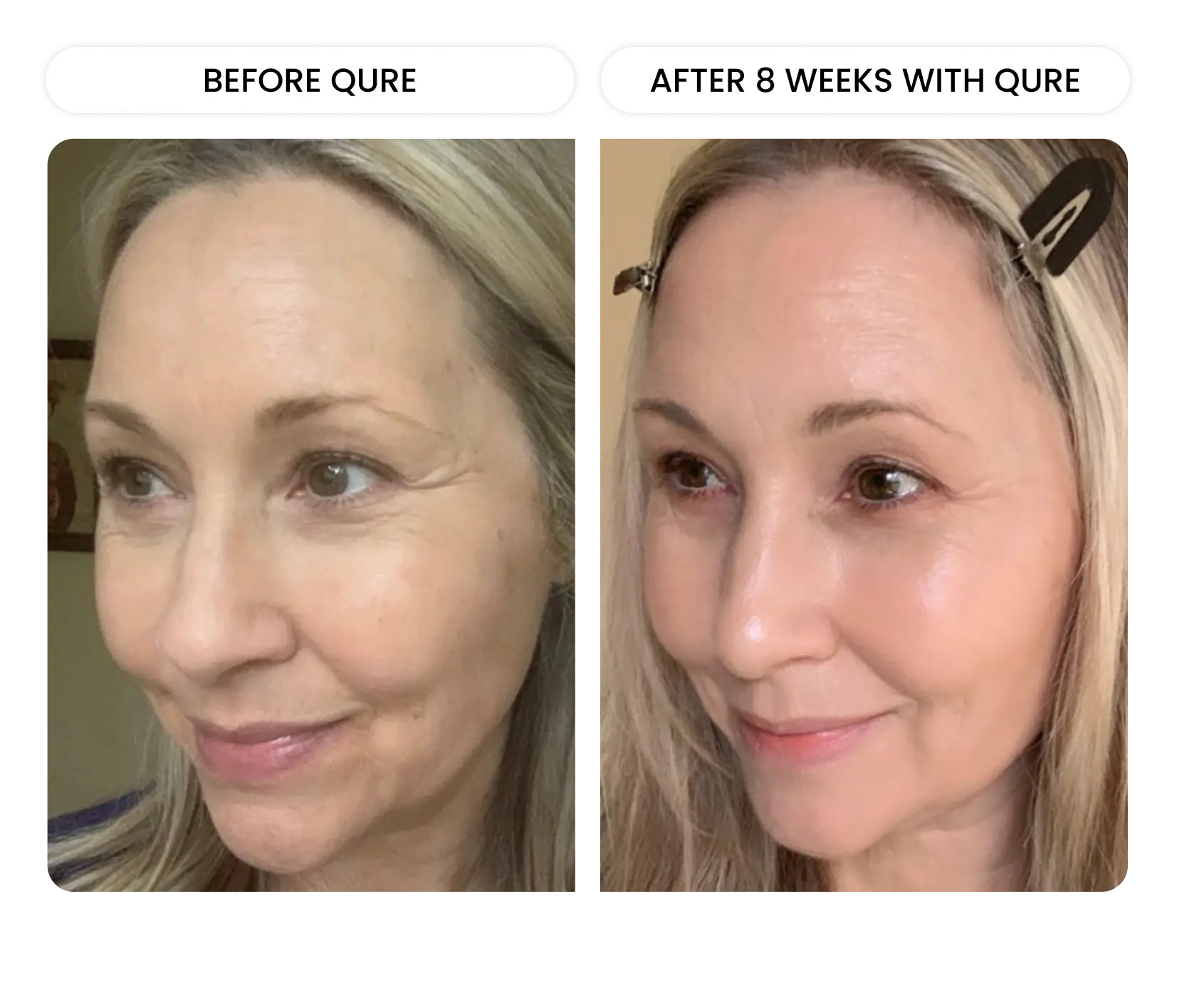 Q-Rejuvalight Pro-Facewear